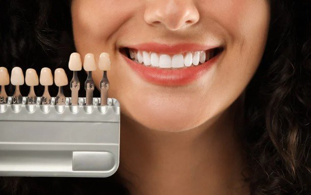 Why Professional Teeth Bleaching Offers More Value
